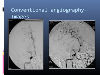 Conventional angiography-
Images
 