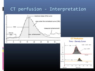 CT perfusion - Interpretation
 