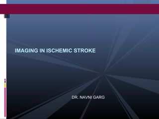 IMAGING IN ISCHEMIC STROKE
DR. NAVNI GARG
 