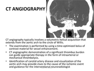 CT ANGIOGRAPHY
CT angiography typically involves a volumetric helical acquisition that
extends from the aortic arch to the circle of Willis.
• The examination is performed by using a time-optimized bolus of
contrast material for vessel enhancement.
• CT angiographic demonstration of a significant thrombus burden
can guide appropriate therapy in the form of intraarterial or
mechanical thrombolysis.
• Identification of carotid artery disease and visualization of the
aortic arch may provide clues to the cause of the ischemic event
and guidance for the interventional neuroradiologist
DR.SVM MDRD
 