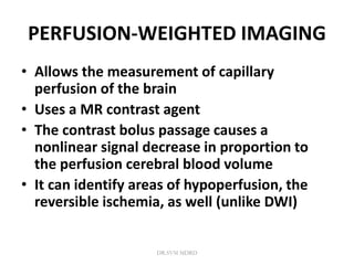 PERFUSION-WEIGHTED IMAGING
• Allows the measurement of capillary
perfusion of the brain
• Uses a MR contrast agent
• The contrast bolus passage causes a
nonlinear signal decrease in proportion to
the perfusion cerebral blood volume
• It can identify areas of hypoperfusion, the
reversible ischemia, as well (unlike DWI)
DR.SVM MDRD
 