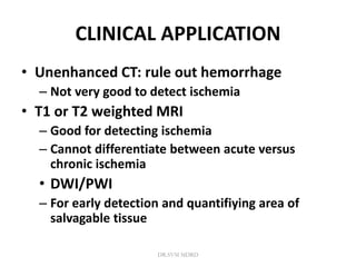 CLINICAL APPLICATION
• Unenhanced CT: rule out hemorrhage
– Not very good to detect ischemia
• T1 or T2 weighted MRI
– Good for detecting ischemia
– Cannot differentiate between acute versus
chronic ischemia
• DWI/PWI
– For early detection and quantifiying area of
salvagable tissue
DR.SVM MDRD
 