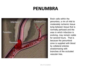 PENUMBRA
Brain cells within the
penumbra, a rim of mild to
moderately ischemic tissue
lying between tissue that is
normally perfused and the
area in which infarction is
evolving, may remain viable
for several hours. That is
because the penumbral
zone is supplied with blood
by collateral arteries
anastomosing with
branches of the occluded
vascular tree.
DR.SVM MDRD
 