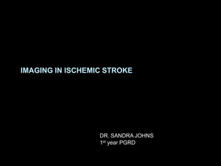 IMAGING IN ISCHEMIC STROKE
DR. SANDRA JOHNS
1st year PGRD
 