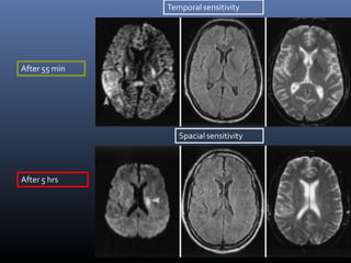 Temporal sensitivity
Spacial sensitivity
After 55 min
After 5 hrs
 