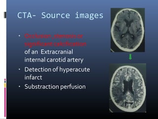 CTA- Source images
▪ Occlusion ,stenosis or
significant calcification
of an Extracranial
internal carotid artery
▪ Detection of hyperacute
infarct
▪ Substraction perfusion
 