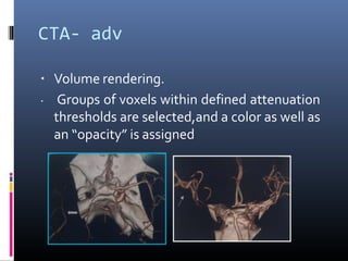 CTA- adv
▪ Volume rendering.
▪ Groups of voxels within defined attenuation
thresholds are selected,and a color as well as
an “opacity” is assigned
 