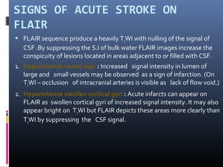 SIGNS OF ACUTE STROKE ON
FLAIR
 FLAIR sequence produce a heavily T2WI with nulling of the signal of
CSF .By suppressing the S.I of bulk water FLAIR images increase the
conspicuity of lesions located in areas adjacent to or filled with CSF.
1. Hyperintense vessel sign : Increased signal intensity in lumen of
large and small vessels may be observed as a sign of infarction. (On
T2WI – occlusion of intracranial arteries is visible as lack of flow void.)
2. Hyperintense swollen cortical gyri : Acute infarcts can appear on
FLAIR as swollen cortical gyri of increased signal intensity. It may also
appear bright on T2WI but FLAIR depicts these areas more clearly than
T2WI by suppressing the CSF signal.
 
