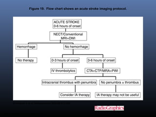 Figure 19. Flow chart shows an acute stroke imaging protocol.
Srinivasan A et al. Radiographics 2006;26:S75-S95
©2006 by Radiological Society of North America
 