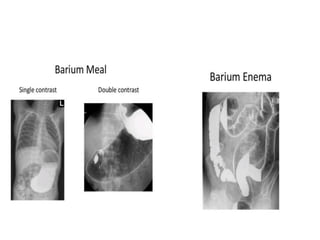 Bari Injection Imaging in surgery | PPT