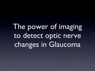 The power of imaging to detect optic nerve changes in Glaucoma 