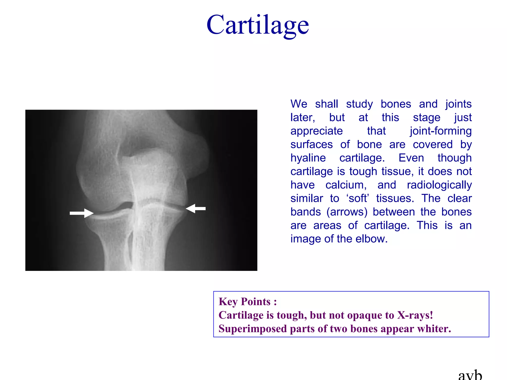 We shall study bones and joints
later, but at this stage just
appreciate that joint-forming
surfaces of bone are covered by
hyaline cartilage. Even though
cartilage is tough tissue, it does not
have calcium, and radiologically
similar to ‘soft’ tissues. The clear
bands (arrows) between the bones
are areas of cartilage. This is an
image of the elbow.
Cartilage
Key Points :
Cartilage is tough, but not opaque to X-rays!
Superimposed parts of two bones appear whiter.
 
