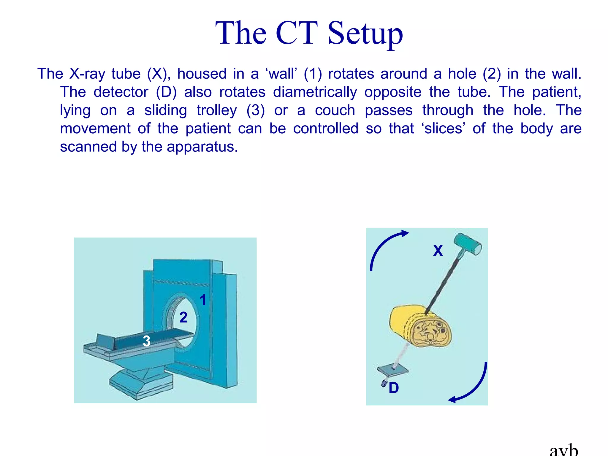 The CT Setup
The X-ray tube (X), housed in a ‘wall’ (1) rotates around a hole (2) in the wall.
The detector (D) also rotates diametrically opposite the tube. The patient,
lying on a sliding trolley (3) or a couch passes through the hole. The
movement of the patient can be controlled so that ‘slices’ of the body are
scanned by the apparatus.
1
2
3
X
D
 