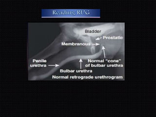 Imaging in urology | PPTX