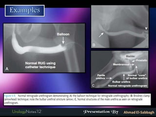Imaging in urology: part 2 other conventional imaging | PDF