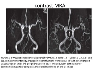 Imaging ischemic infarction.pptx