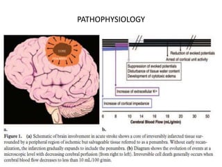 PATHOPHYSIOLOGY
 