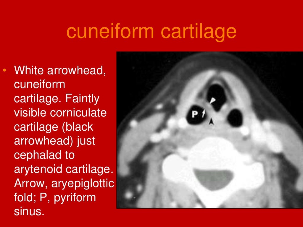 larynx Imaging 1st part laryngeal anatomy CT MRI Dr Ahmed Esawy
