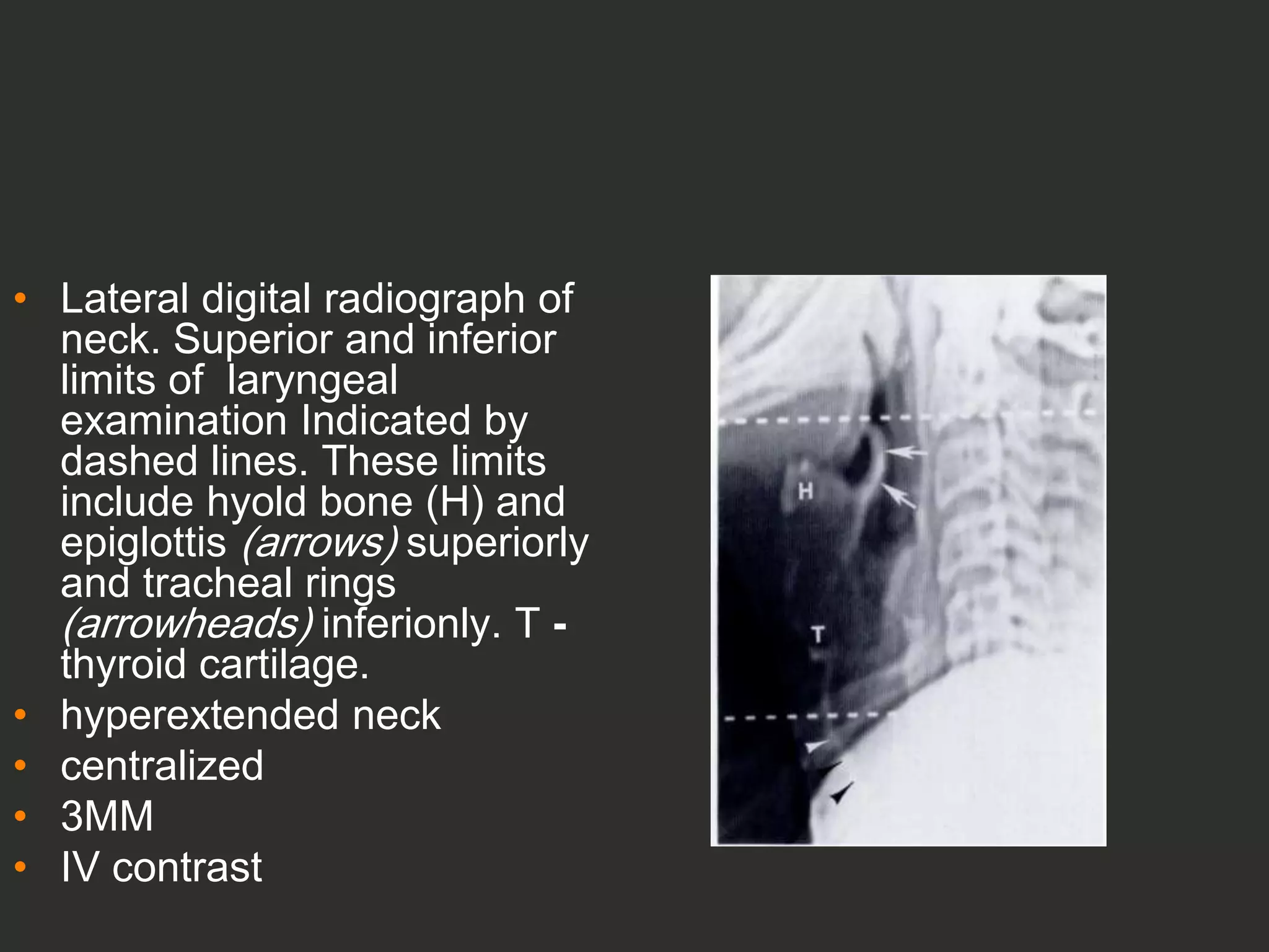 Inlet Scan Position Full Story larynx Imaging CT MRI Dr Ahmed Esawy | PPT
