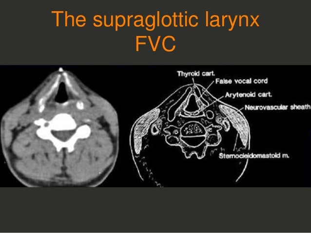 Full Story larynx Imaging CT MRI Dr Ahmed Esawy