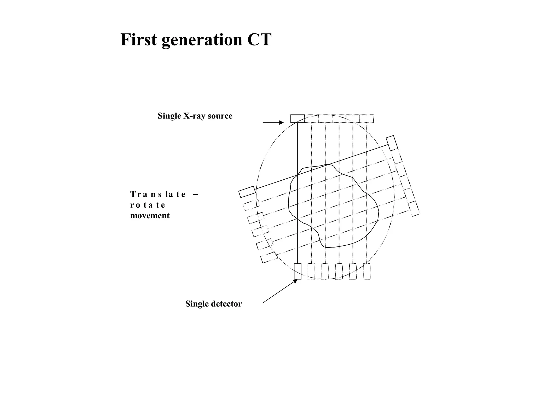 First generation CT Single X-ray source Single detector Translate – rotate movement 