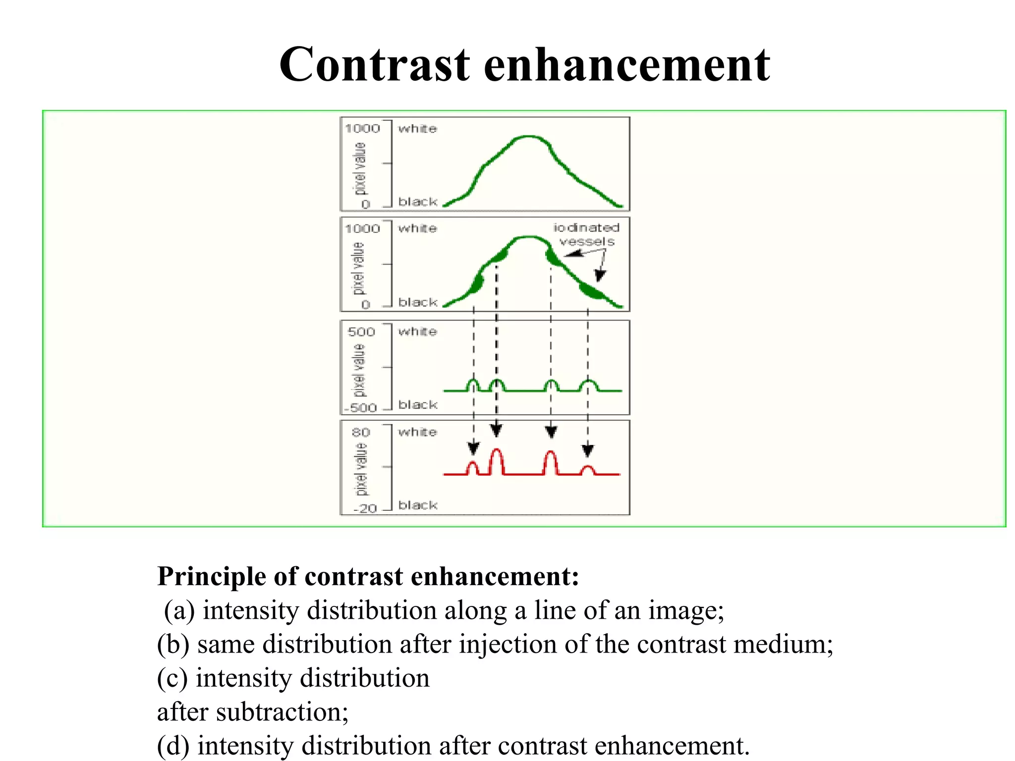 Contrast enhancement Principle of contrast enhancement: (a) intensity distribution along a line of an image; (b) same distribution after injection of the contrast medium;  (c) intensity distribution after subtraction;  (d) intensity distribution after contrast enhancement.  
