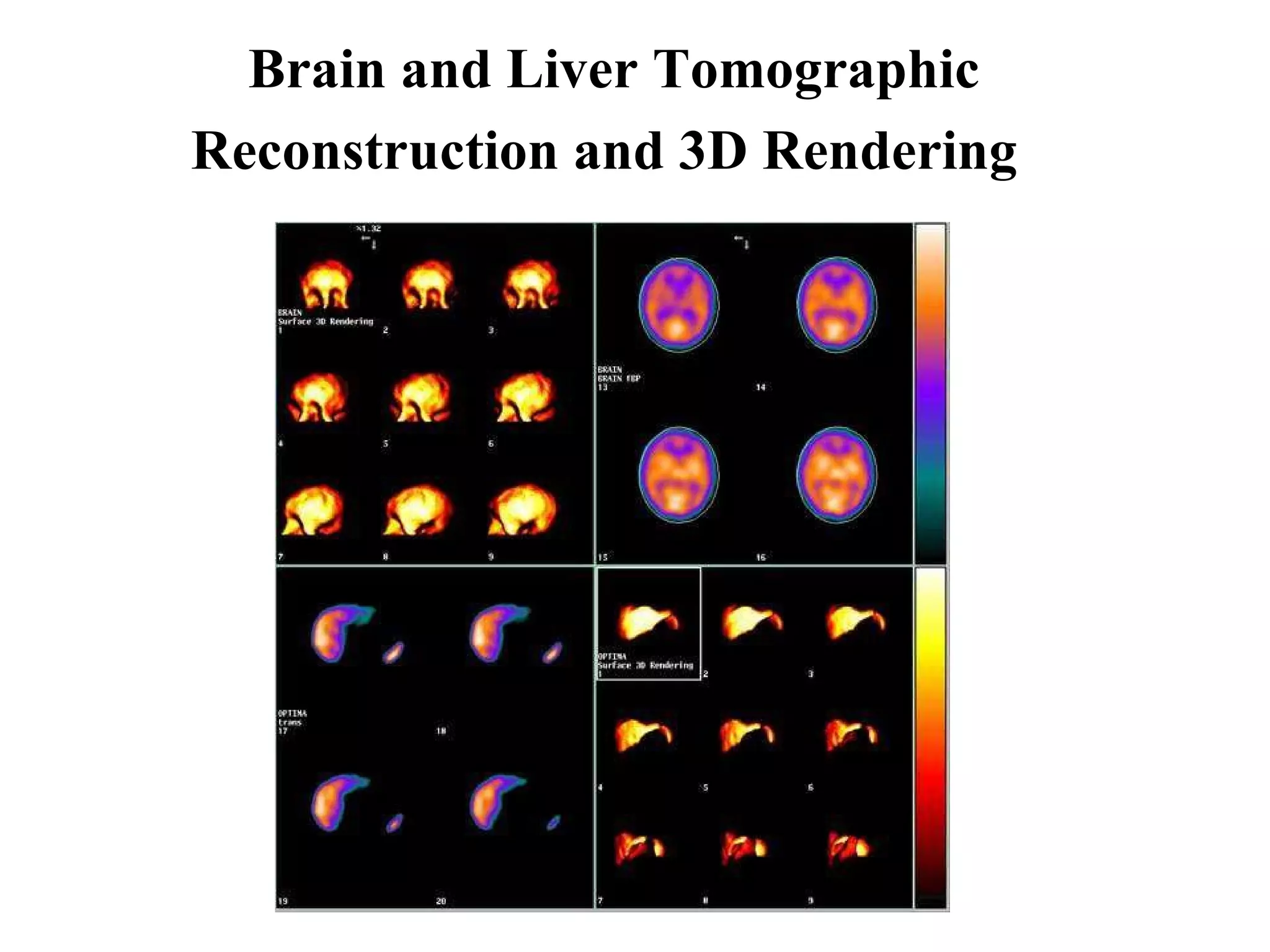 Brain and Liver Tomographic Reconstruction and 3D Rendering   