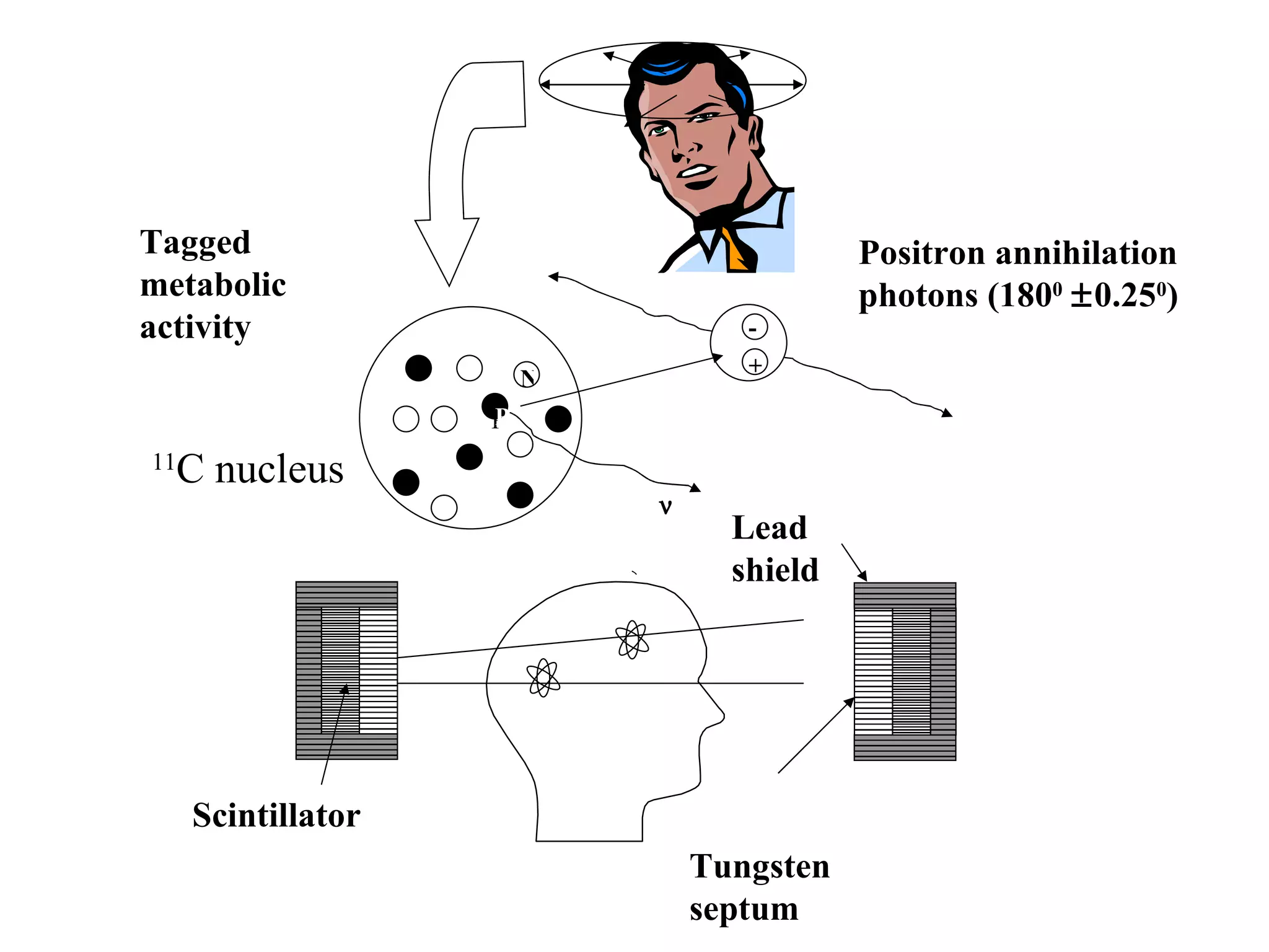 Tungsten septum Scintillator Lead shield P P N  + - Positron annihilation photons (180 0    0.25 0 ) Tagged metabolic activity 11 C nucleus 