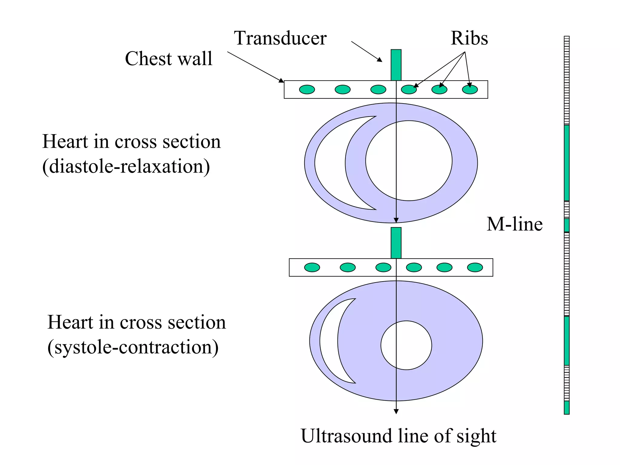 Heart in cross section (diastole-relaxation) Heart in cross section (systole-contraction) M-line   Transducer Chest wall Ribs Ultrasound line of sight 