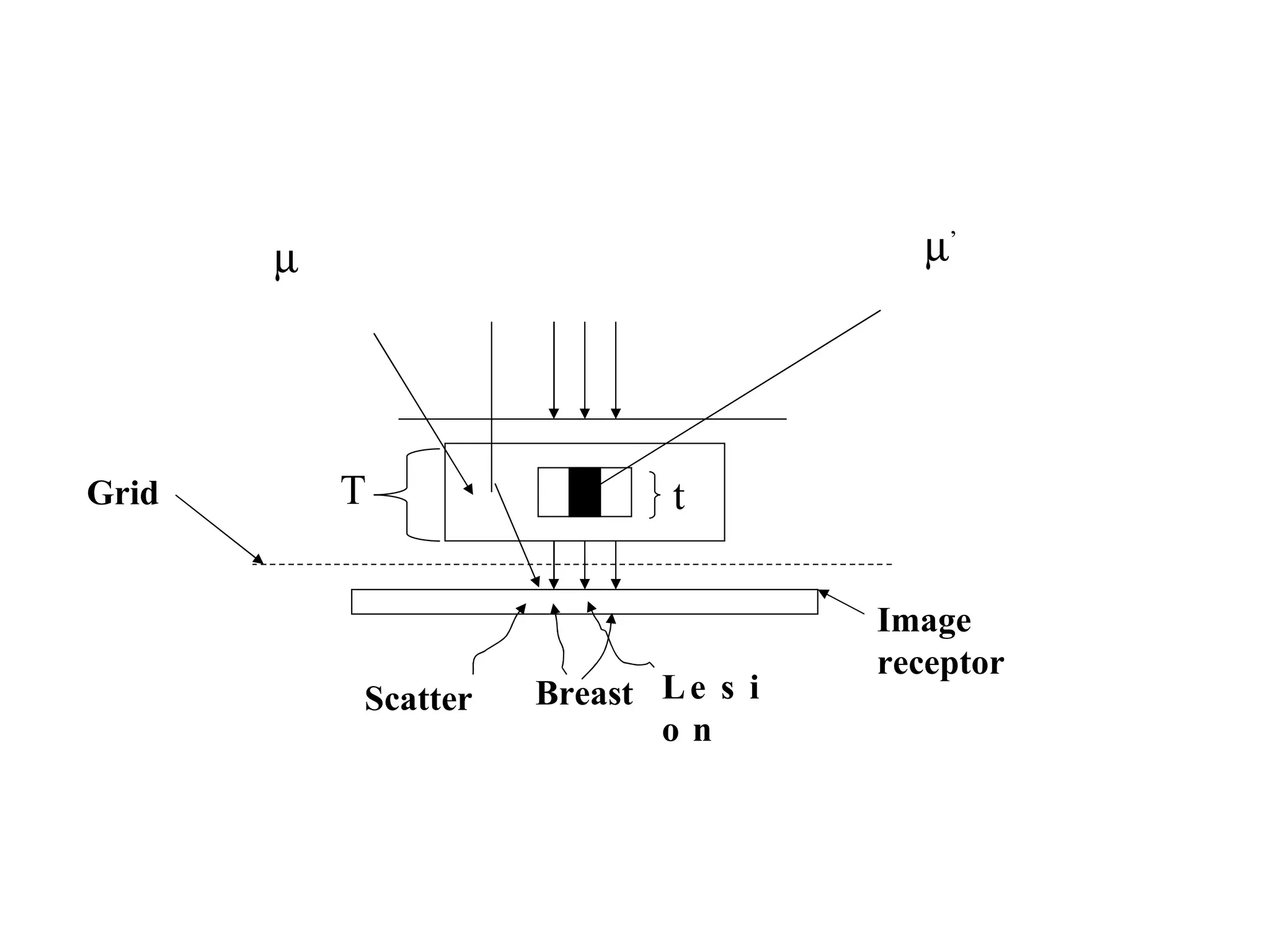 Image receptor Lesion Breast Scatter Grid T   ’ t 