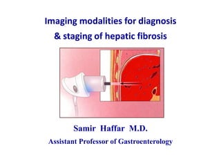 Imaging modalities for diagnosis
& staging of hepatic fibrosis
Samir Haffar M.D.
Assistant Professor of Gastroenterology
 