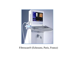 Fibroscan® (Echosens, Paris, France)
 