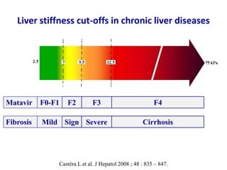 Liver stiffness cut-offs in chronic liver diseases
F2
Sign
F3
Severe
F4
Cirrhosis
Matavir F0-F1
MildFibrosis
Castéra L et ...