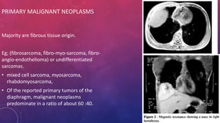 Imaging modalities of diaphragm | PPTX
