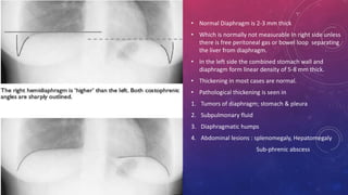 Imaging modalities of diaphragm | PPT