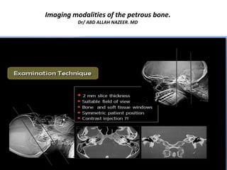Imaging modalities of the petrous bone.
Dr/ ABD ALLAH NAZEER. MD.
 