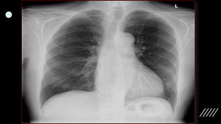 Imaging ofsplenic diseases [Autosaved].pptx