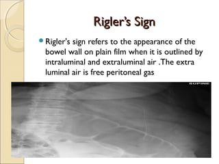 Imaging of acute abdomen | PPT
