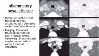 Tracheitis Radiology Imaging of large and small airway diseases.pptx