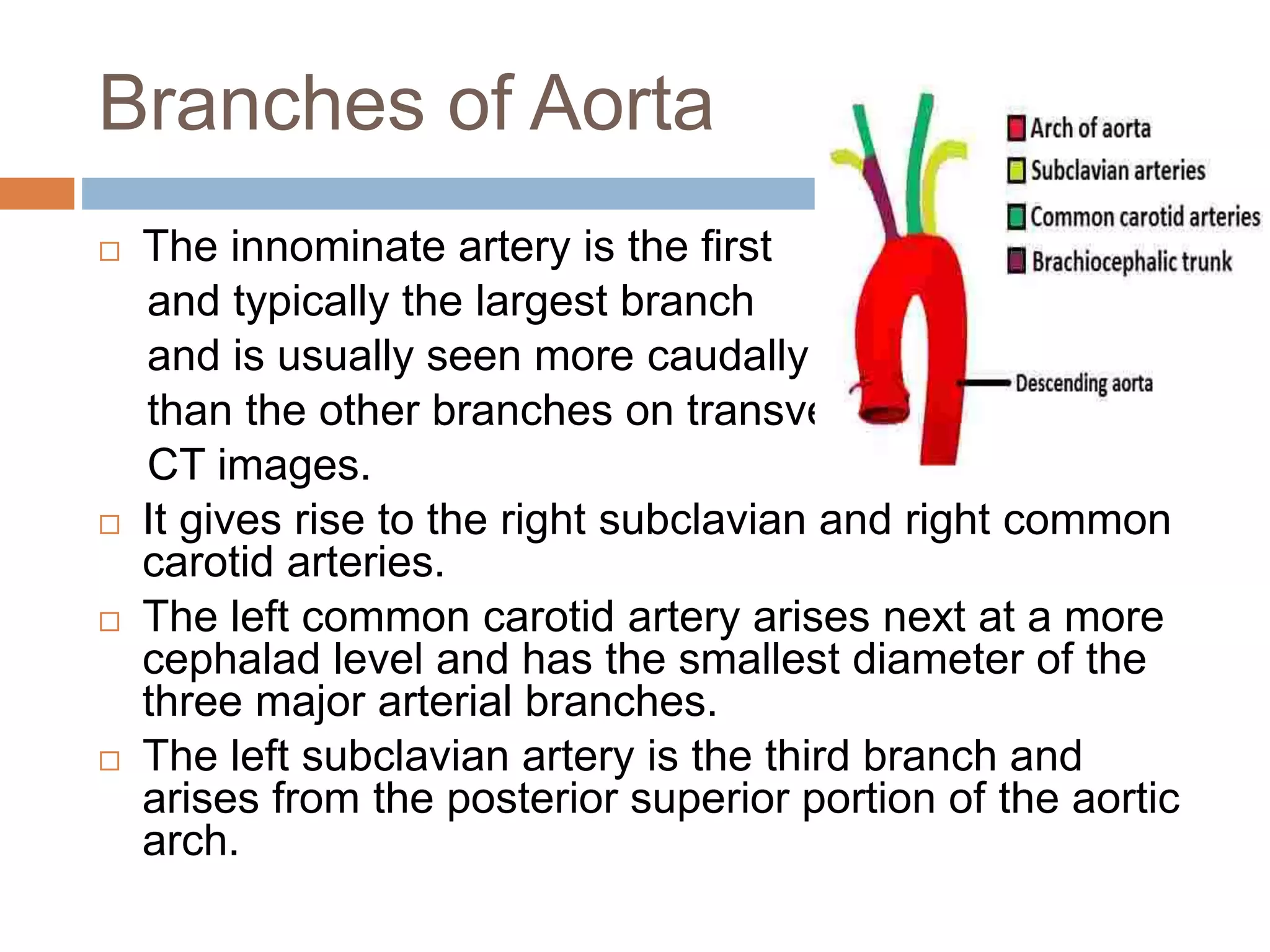 Imaging of aortic pathologies | PPTX