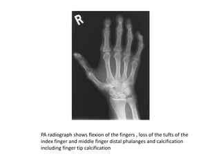 Imaging of arthritis.pptx
