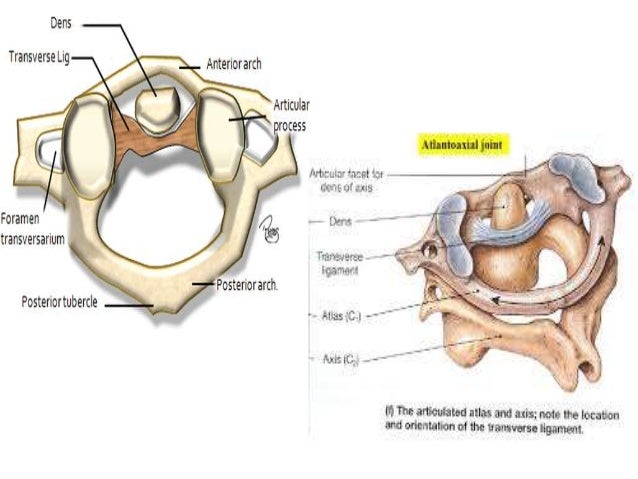 atlantoaxial joint