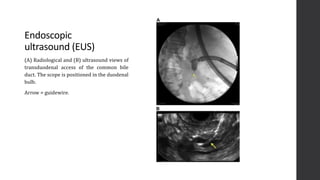 Imaging of the Biliary System and its Disorders | PPTX
