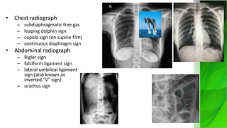 Imaging of blunt abdominal trauma.pptx