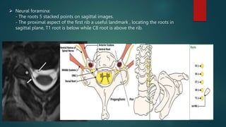 Imaging of brachial plexus.Radiology pptx | PPTX