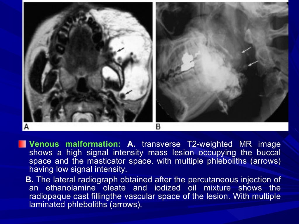 Imaging of buccal space