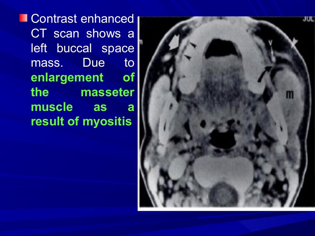 Imaging of buccal space