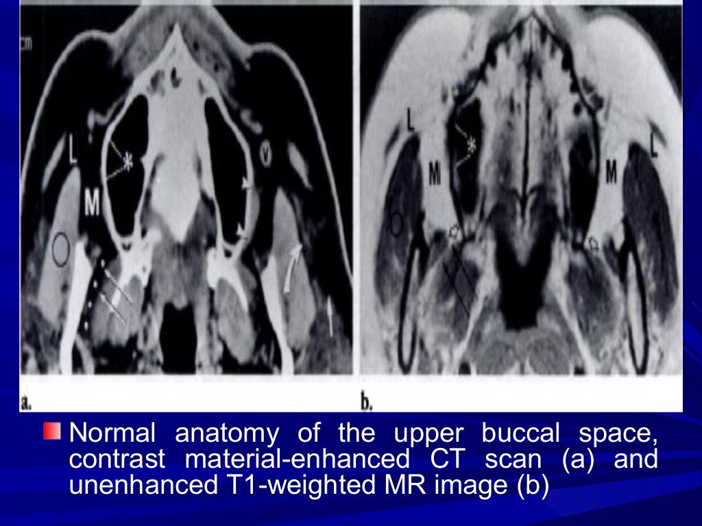 Imaging of buccal space