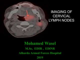 IMAGING OF
CERVICAL
LYMPH NODES
Mohamed Wasel
M.Sc, EDIR , EDiNR
Alharda Armed Forces Hospital
2019
 