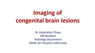 Imaging of
congenital brain lesions
Dr. Gobardhan Thapa
MD Resident
Radiology Department
NAMS, Bir Hospital, Kathmandu
 